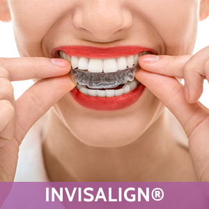 Invisalign in Hercules