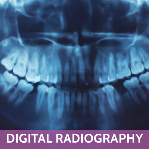 Xray in Hercules